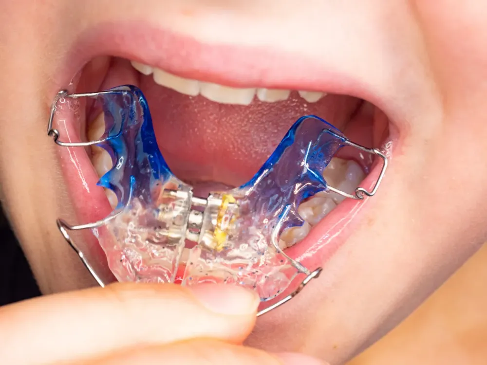 Orthodontiste à NEUILLY-SUR-SEINE