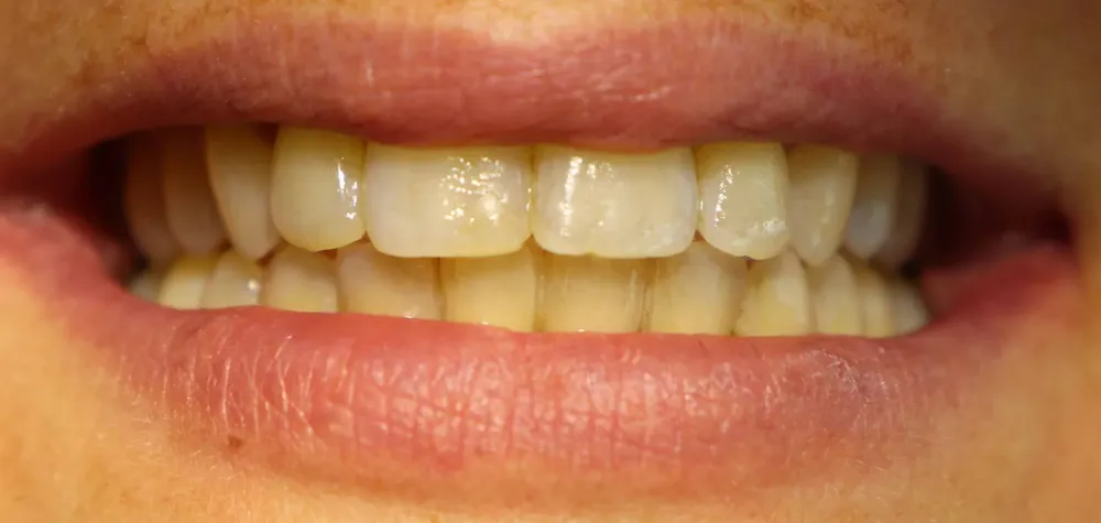 Patients Dr Saran (8)