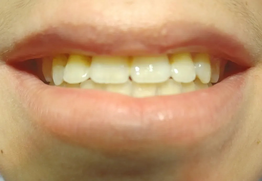 dentition (4)