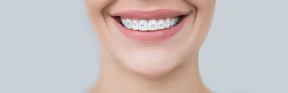 Orthodontiste spécialiste à Neuilly-sur-Seine (1webp